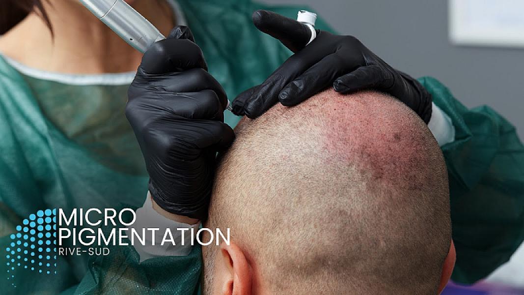 Micropigmentation Rive-Sud