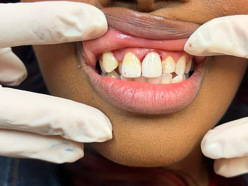 Briar Forest Dental Group